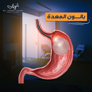 Slider image (4) Dr. Ahmed Yousry Clinic